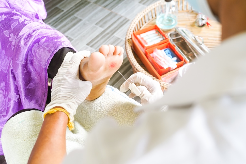 a podiatrist treats a small wound on the bottom of the foot during a foot examination for diabetes care