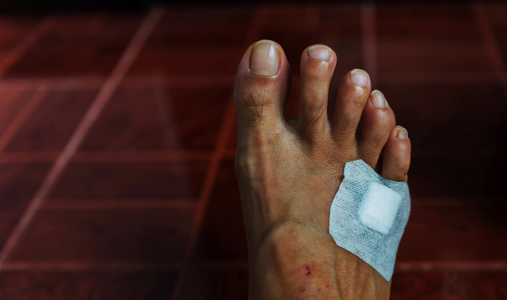 Podiatrist or Dermatologist? Who to See for Athlete’s Foot, Plantar Warts, and Other Foot Conditions