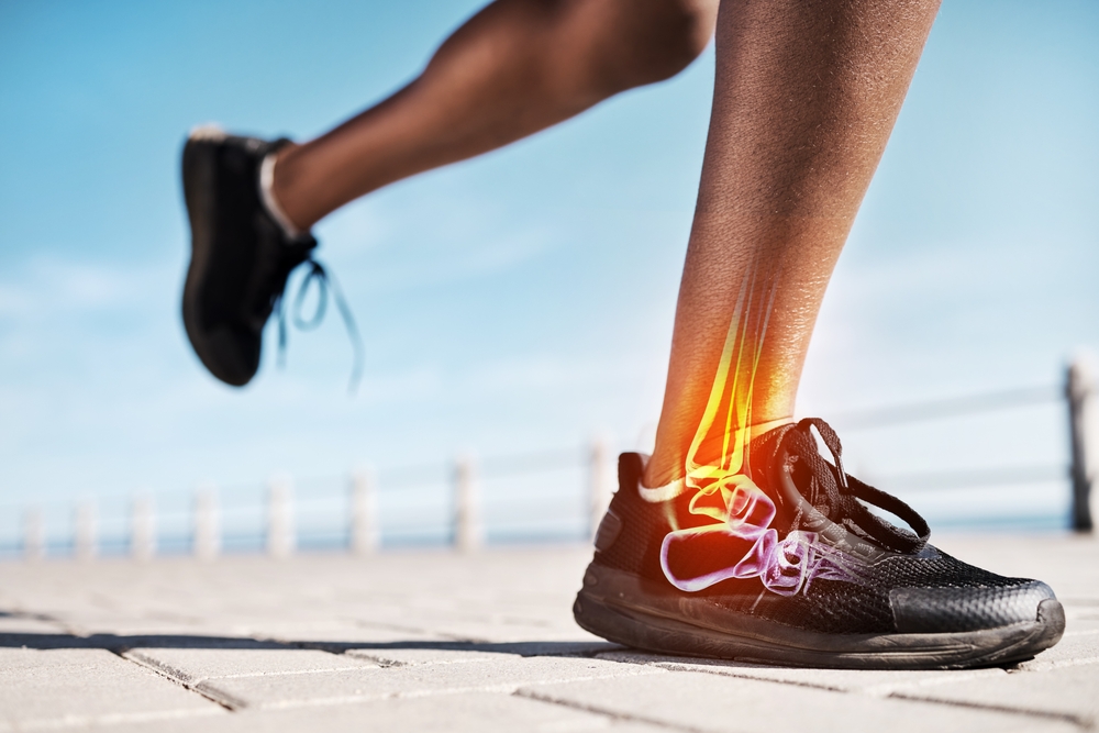 The Most Common Foot Injuries from Running Explained