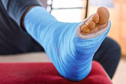 Broken foot and ankle treatment in the Aiken, SC 2980, Beaufort, SC 29902, Cayce, SC 29033, Columbia, SC 29204 and 29203, Florence, SC 29501, Hartsville, SC 29550, Hinesville, GA 31313, Mount Pleasant, SC 29464, Newberry, SC 29108, North Charleston, SC 29418, Orangeburg, SC 29115, Savannah, GA 31405, Summerville, SC 29486, Sumter, SC 29150, and Charleston, SC 29414 areas