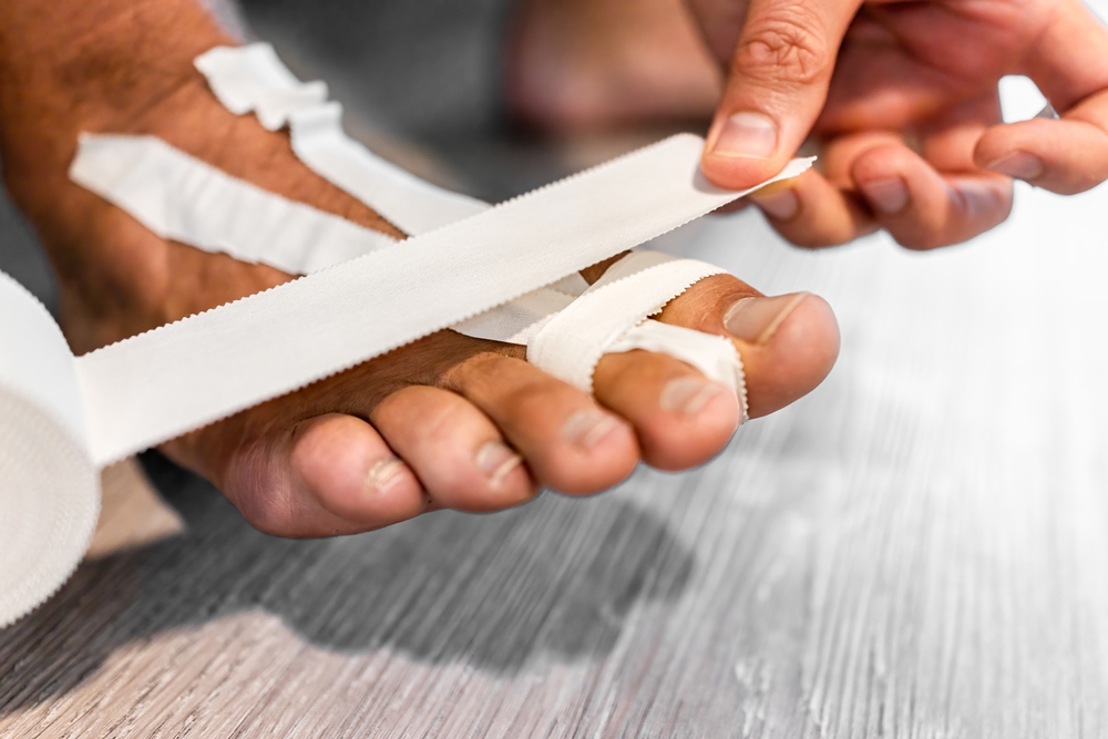 Do You Need a Podiatrist for Turf Toe? Treatment, Rehab, and Recovery Explained