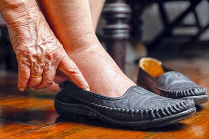 Senior Feet, elderly foot care treatment in the Aiken, SC 2980, Beaufort, SC 29902, Cayce, SC 29033, Columbia, SC 29204 and 29203, Florence, SC 29501, Hartsville, SC 29550, Hinesville, GA 31313, Mount Pleasant, SC 29464, Newberry, SC 29108, North Charleston, SC 29418, Orangeburg, SC 29115, Savannah, GA 31405, Summerville, SC 29486, Sumter, SC 29150, and Charleston, SC 29414 areas